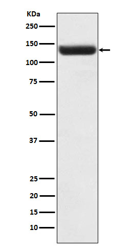ZNF217