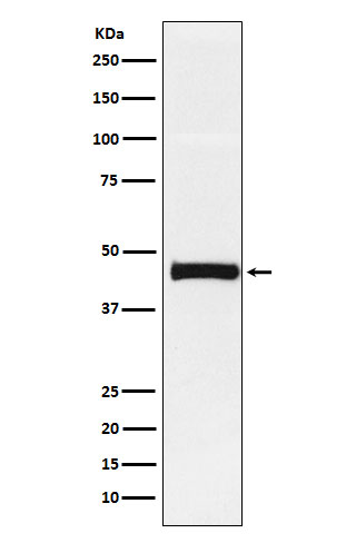 Pentraxin 3