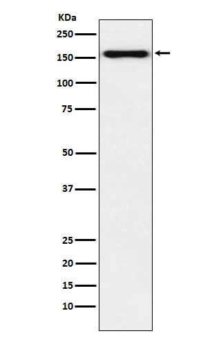Desmoglein 2