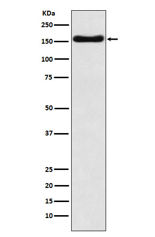ATP7b