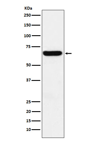 Methionine Aminopeptidase 2