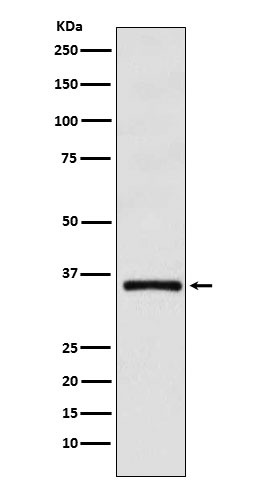 DMRT1