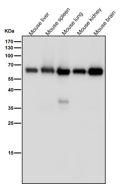 Monoamine Oxidase A