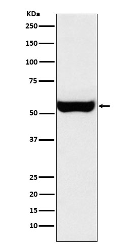 Monoamine Oxidase B