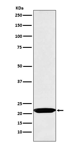 Oncostatin M