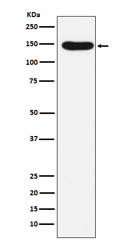 Desmoglein 3