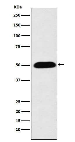 CYP27A1