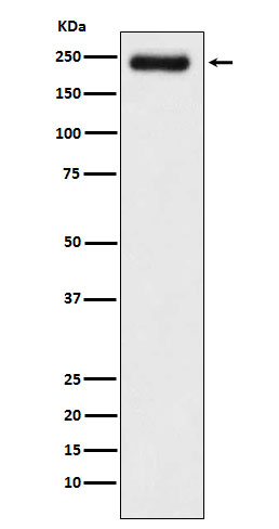 Laminin gamma 1