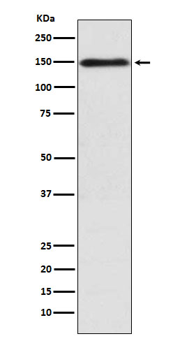 COL11A1