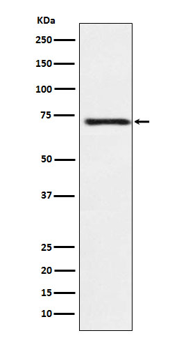 Guanylyl Cyclase beta1