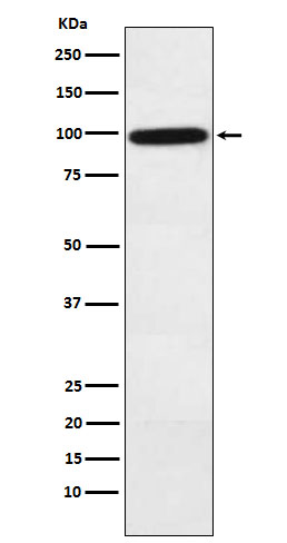Complement factor B