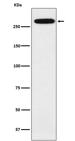 alpha 1 Spectrin