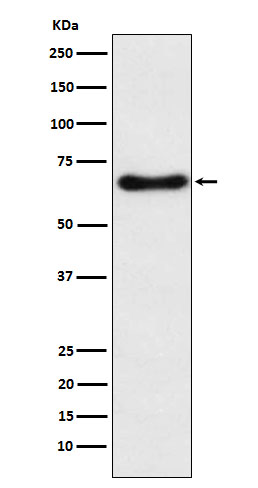 CYP24A1