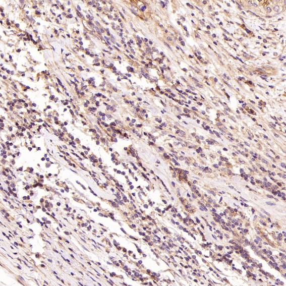 Rabbit Monoclonal to HCadherin