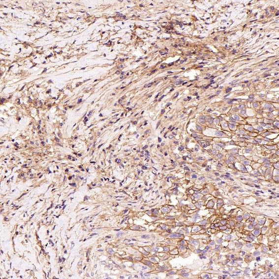 Rabbit Monoclonal to HCadherin