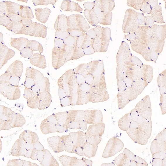 Rabbit Monoclonal to HCadherin