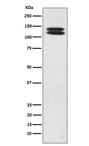 HCadherin