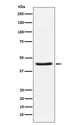 HSD3B1
