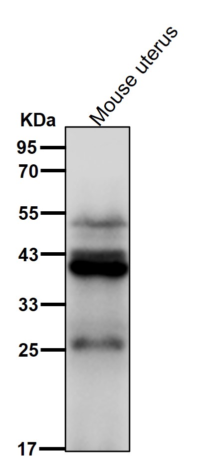 Rabbit Monoclonal to HSD3B1