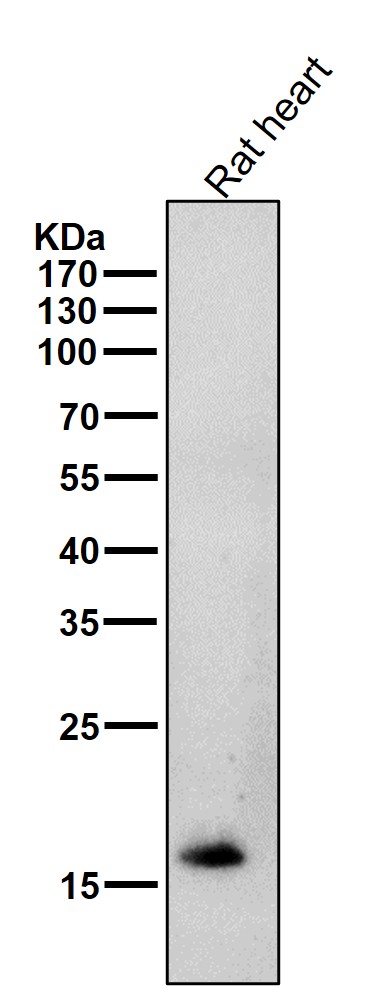 Cardiac Troponin C