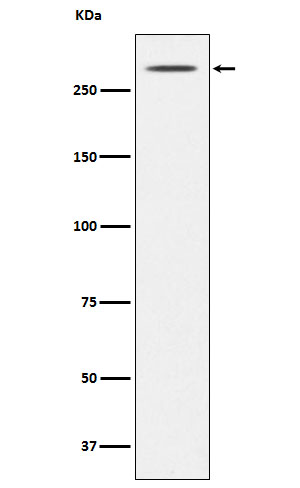 Thyroglobulin