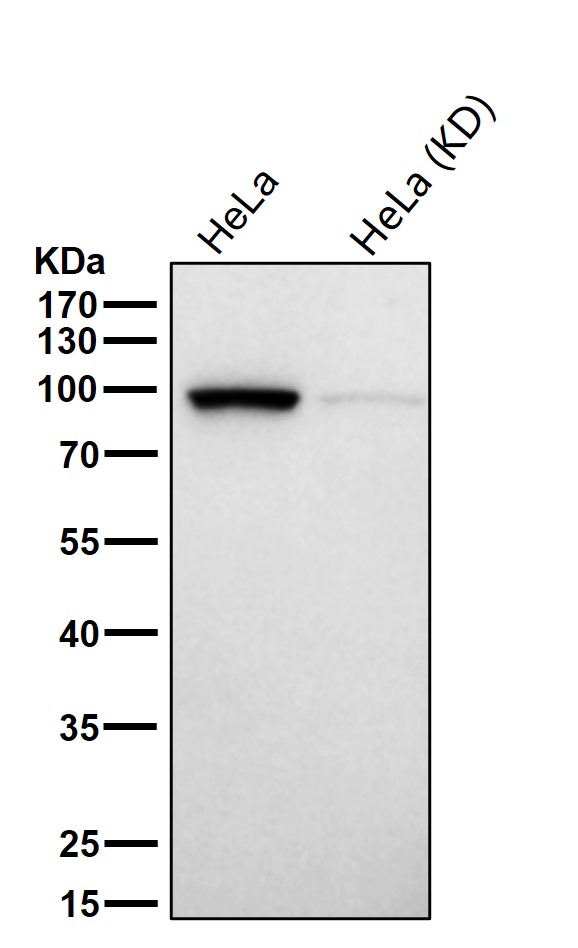 Rabbit Monoclonal to AP1G1