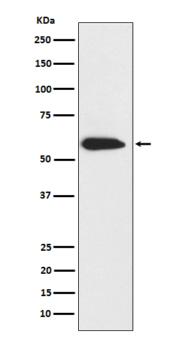 Cytokeratin 6