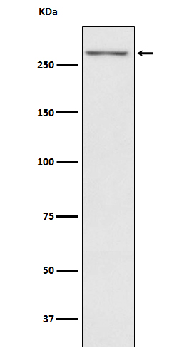 Thyroglobulin