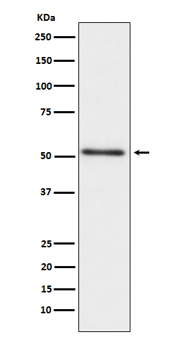 ProstaticAcidPhosphatase