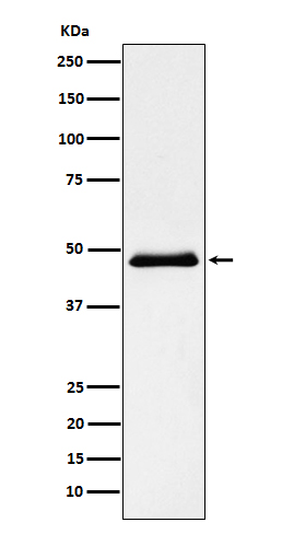 Pancreatic Lipase（PNLIP）
