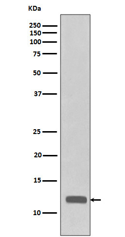 CCL23/MIP3