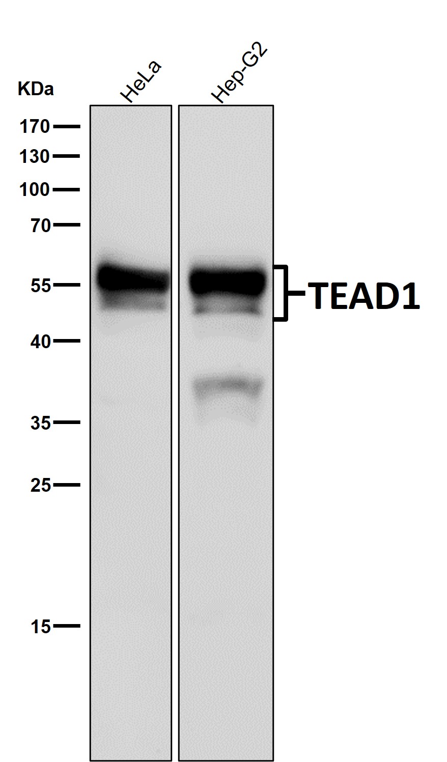 TEAD1