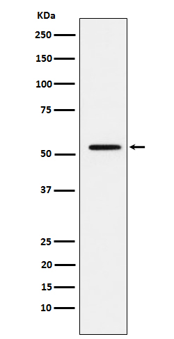 MMP1