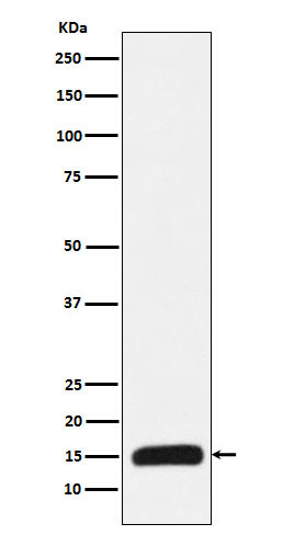 Histone H3(mutatedK27Met)