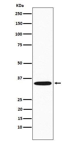 GNB2