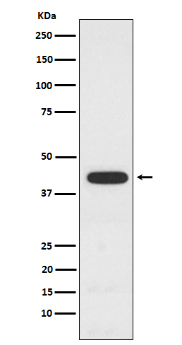 PCYT1A