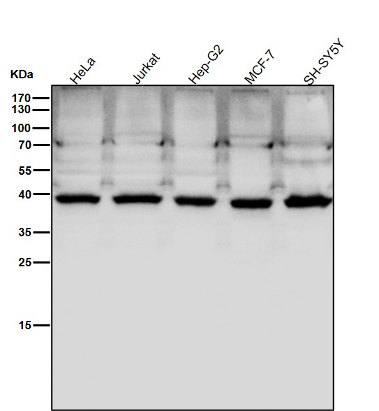 Rabbit Monoclonal to PCYT1A