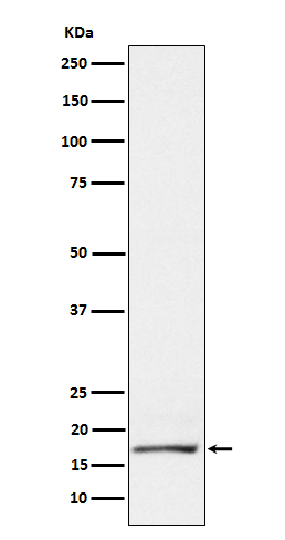 GCDFP15
