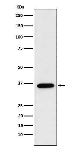 FBP1