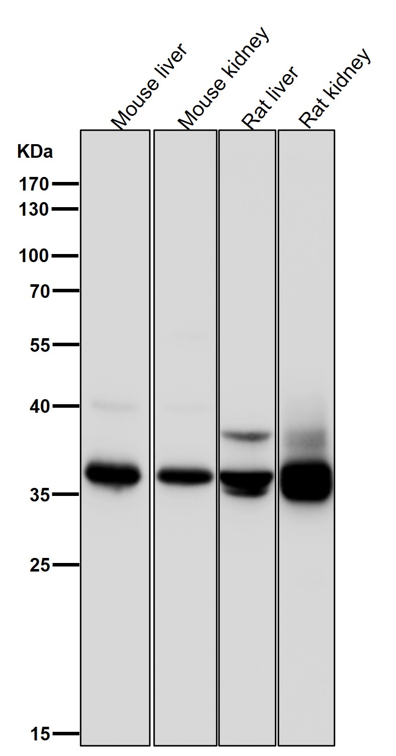 Rabbit Monoclonal to FBP1