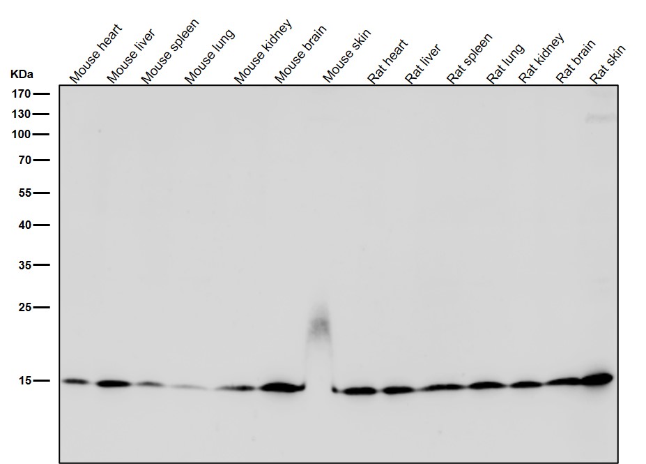 Histone H3(acetylK27)