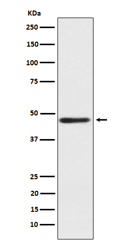 ENTPD5