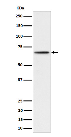 Phospho-P70S6 Kinase beta(S371)