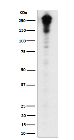Desmoplakin
