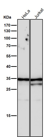 Rabbit Monoclonal to NEK7