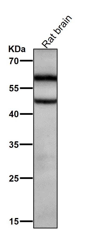 Phospho-CaMKII alpha(T286)