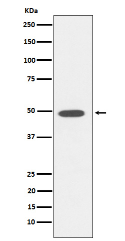 DP1