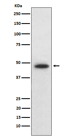 Wnt5b