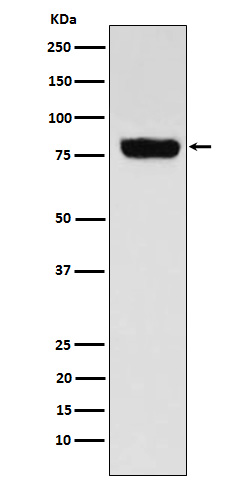 SLC22A3