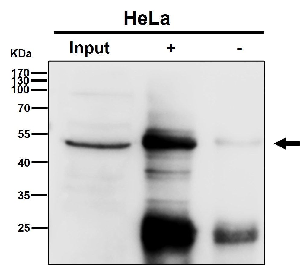 Rabbit Monoclonal to EEF1G